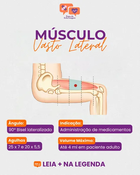 Região da Coxa: Vasto Lateral