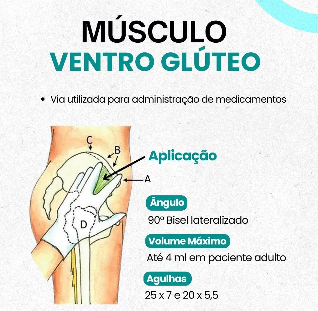 Triângulo do Ventroglúteo